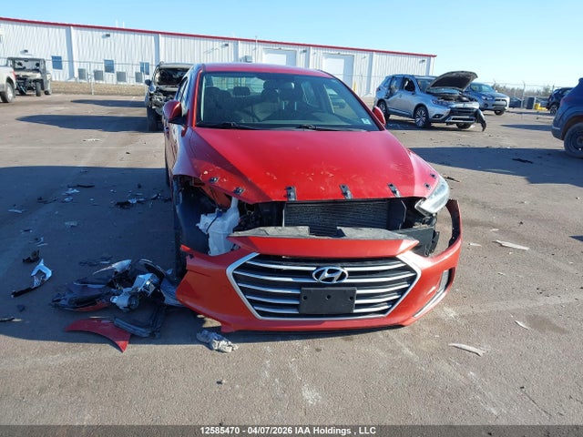 12585470 :رقم المزاد ، KMHD84LF9HU376231 vin ، 2017 Hyundai Elantra Se/value/limited مزاد بيع