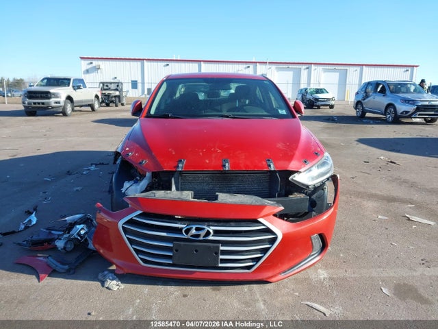 12585470 :رقم المزاد ، KMHD84LF9HU376231 vin ، 2017 Hyundai Elantra Se/value/limited مزاد بيع
