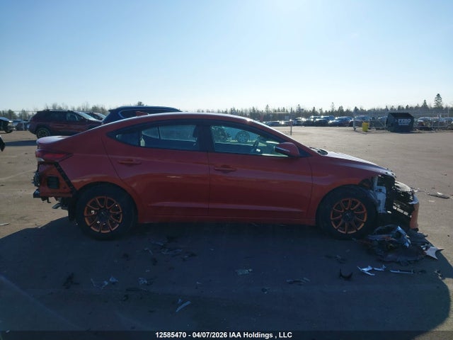 12585470 :رقم المزاد ، KMHD84LF9HU376231 vin ، 2017 Hyundai Elantra Se/value/limited مزاد بيع