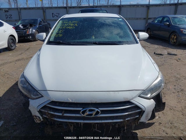 KMHD84LF4JU455490 Hyundai ELANTRA GL