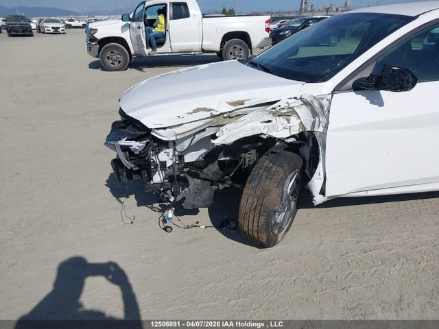 KMHLM4DG6SU906001 Hyundai Elantra Preferred