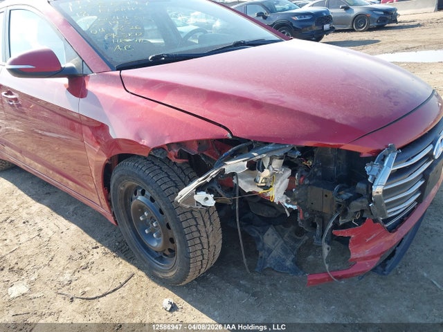 KMHD84LF5JU664432 Hyundai Elantra Sel/value/limited