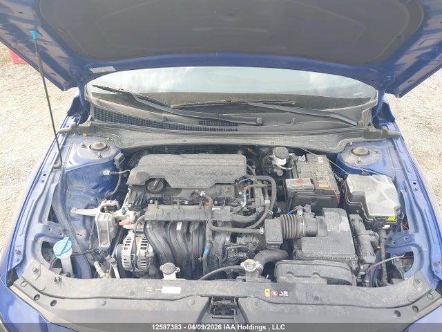 KMHLM4DG7RU666712 Hyundai ELANTRA SEL