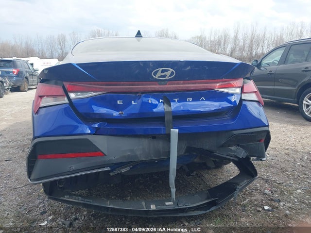 KMHLM4DG7RU666712 Hyundai ELANTRA SEL
