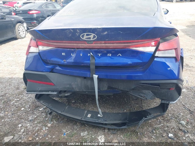 KMHLM4DG7RU666712 Hyundai ELANTRA SEL