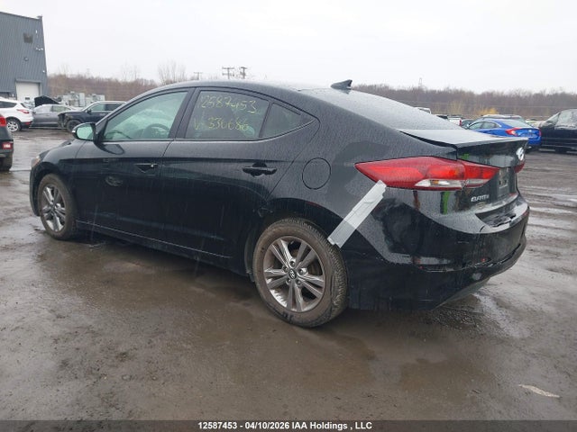 KMHD84LF4HU336686 Hyundai ELANTRA GL
