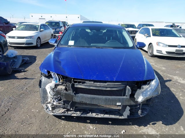 KMHLM4AGXMU123187 Hyundai ELANTRA SEL
