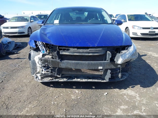 KMHLM4AGXMU123187 Hyundai ELANTRA SEL