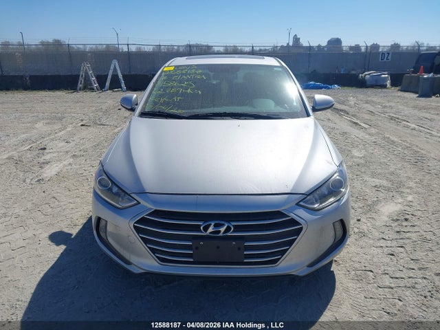 KMHD84LF3HU158625 Hyundai Elantra Se/value/limited