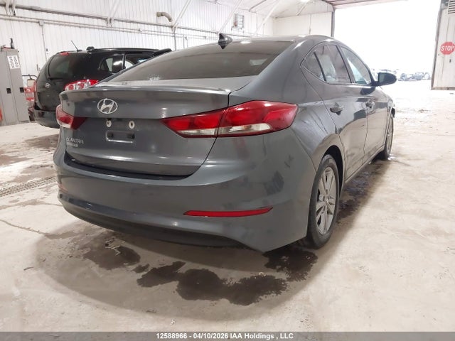 KMHD84LF6HU359810 Hyundai ELANTRA GL