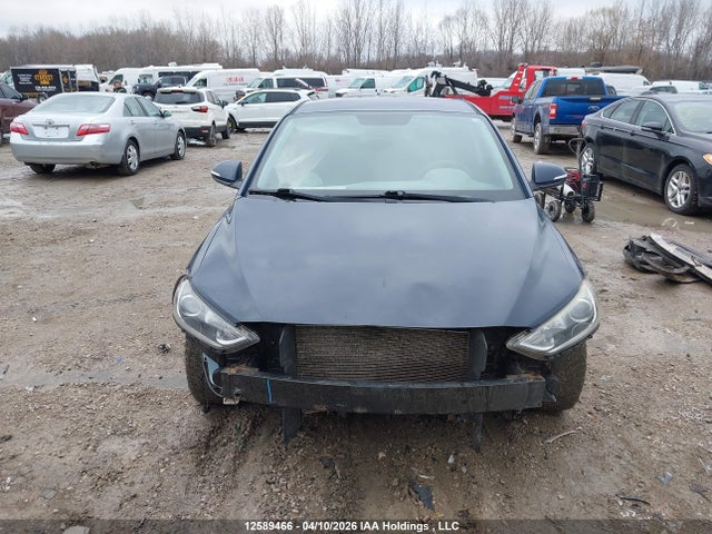 KMHD84LF4HU129621 Hyundai ELANTRA GL