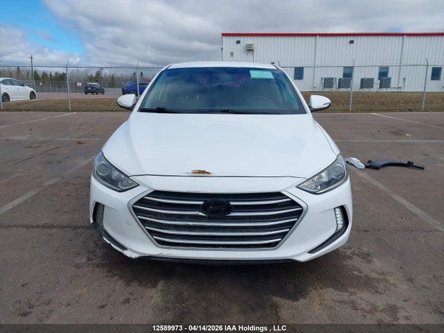 KMHD84LF5HU231574 Hyundai ELANTRA GL