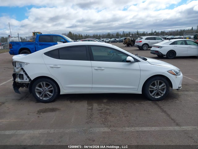 KMHD84LF5HU231574 Hyundai ELANTRA GL