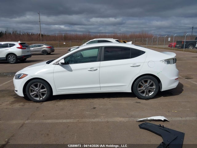 KMHD84LF5HU231574 Hyundai ELANTRA GL
