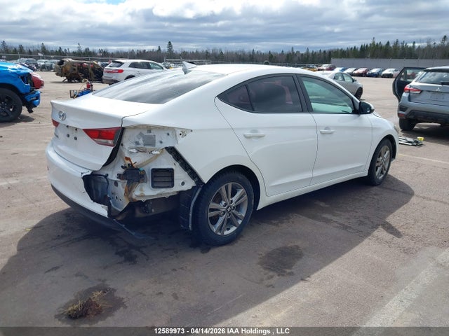 KMHD84LF5HU231574 Hyundai ELANTRA GL