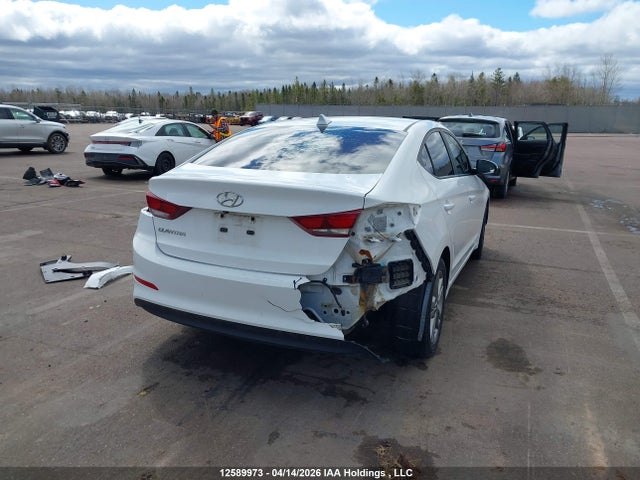 KMHD84LF5HU231574 Hyundai ELANTRA GL