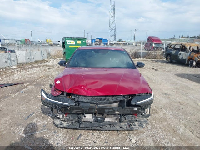 KMHLR4DFXRU730945 Hyundai Elantra
