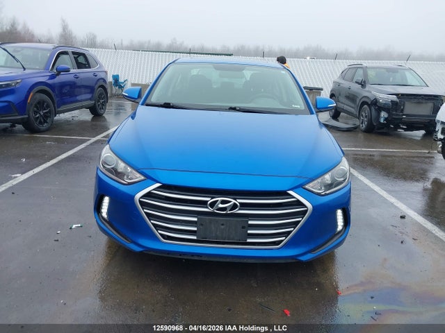 KMHD84LFXHU249729 Hyundai Elantra Gls