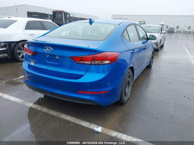KMHD84LFXHU249729 Hyundai Elantra Gls
