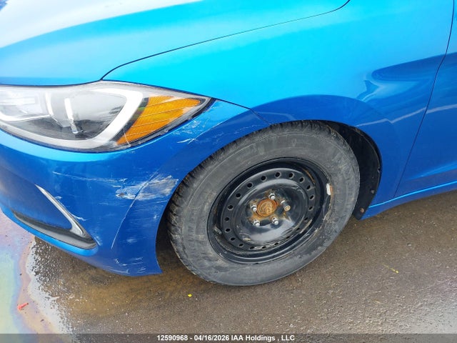 KMHD84LFXHU249729 Hyundai Elantra Gls