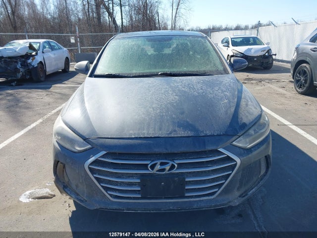 KMHD84LF6HU267449 Hyundai ELANTRA GL