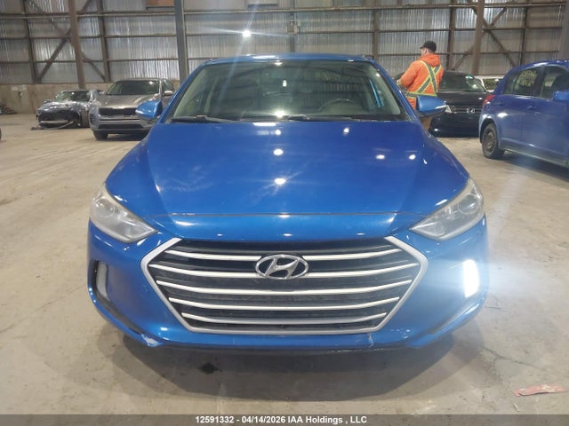 KMHD84LF1HU301135 Hyundai Elantra Se/value/limited