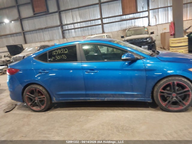 KMHD84LF1HU301135 Hyundai Elantra Se/value/limited