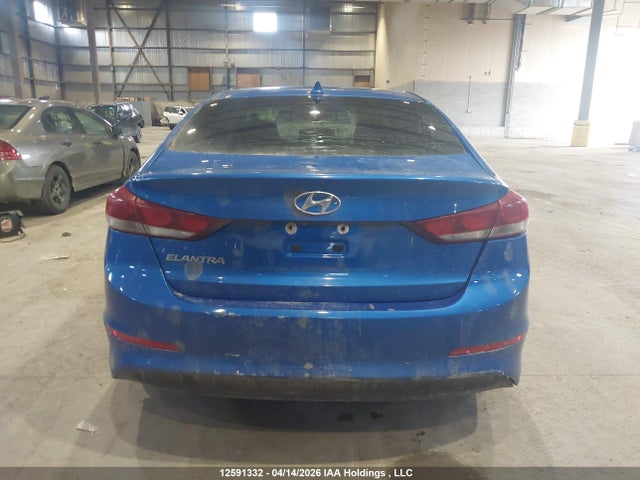 KMHD84LF1HU301135 Hyundai Elantra Se/value/limited