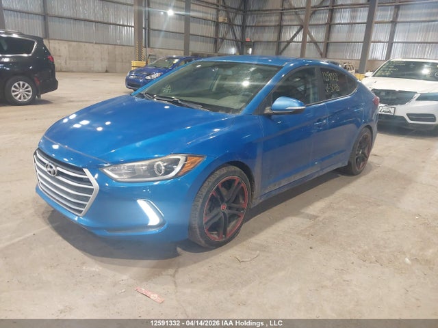 KMHD84LF1HU301135 Hyundai Elantra Se/value/limited
