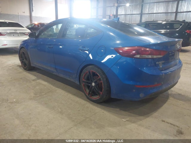 KMHD84LF1HU301135 Hyundai Elantra Se/value/limited