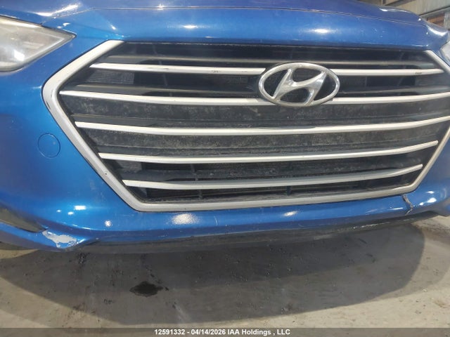 KMHD84LF1HU301135 Hyundai Elantra Se/value/limited