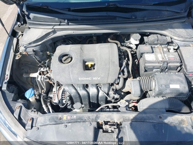 KMHD84LF1HU167100 Hyundai Elantra Se/value/limited