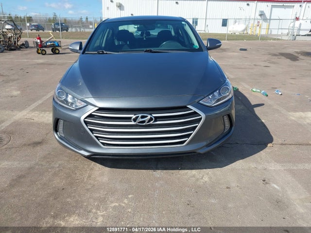 KMHD84LF1HU167100 Hyundai Elantra Se/value/limited