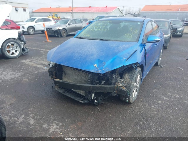 KMHD84LF7JU679840 Hyundai ELANTRA GL