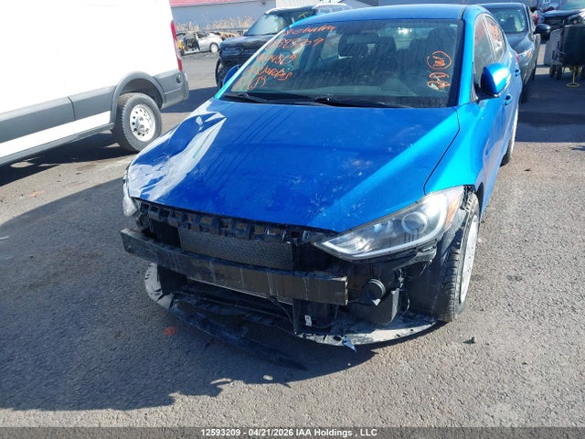 KMHD84LF6JU604515 Hyundai Elantra Sel/value/limited
