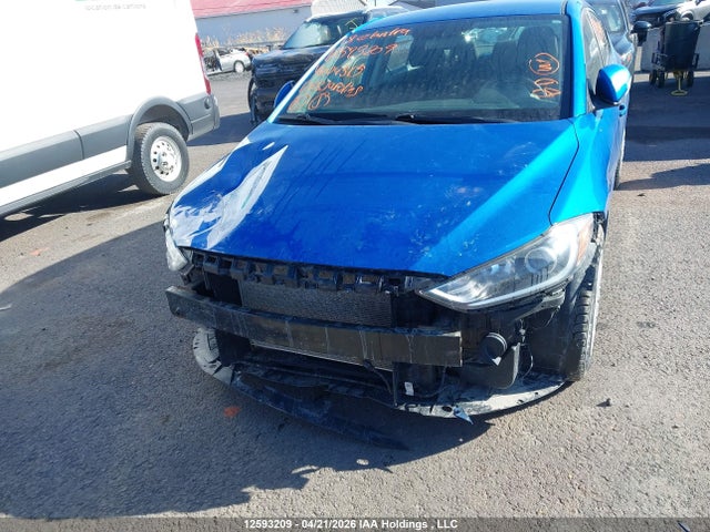 KMHD84LF6JU604515 Hyundai Elantra Sel/value/limited