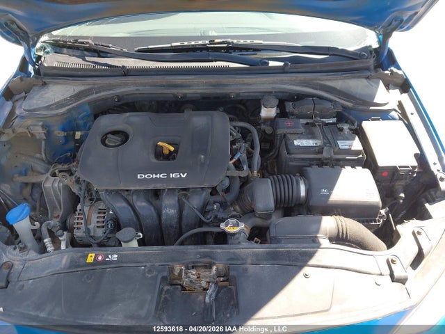 KMHD84LF1HU135831 Hyundai ELANTRA GL