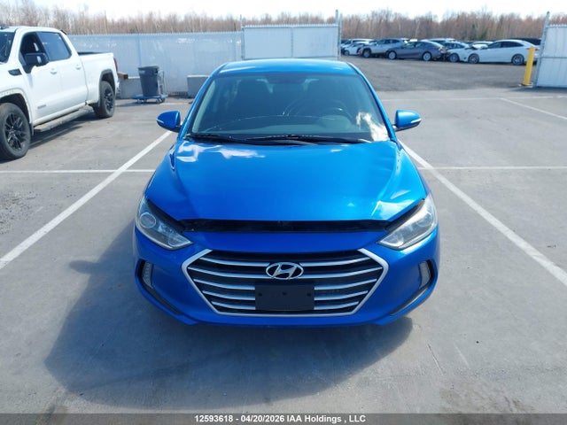 KMHD84LF1HU135831 Hyundai ELANTRA GL