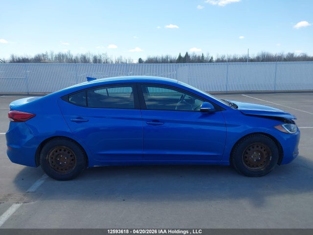 KMHD84LF1HU135831 Hyundai ELANTRA GL