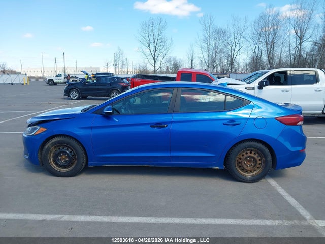 KMHD84LF1HU135831 Hyundai ELANTRA GL