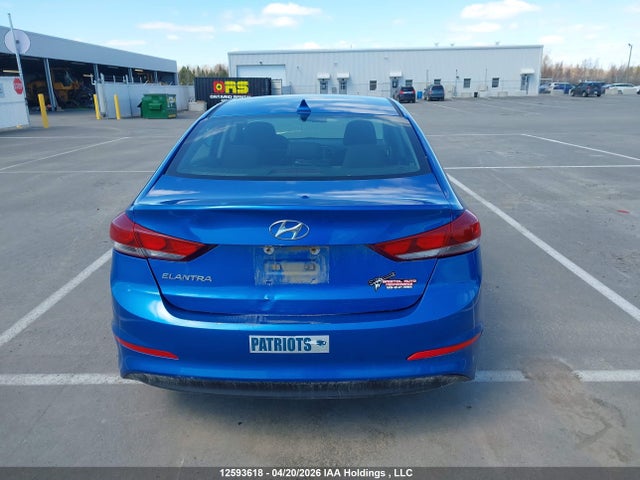 KMHD84LF1HU135831 Hyundai ELANTRA GL