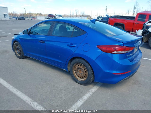 KMHD84LF1HU135831 Hyundai ELANTRA GL