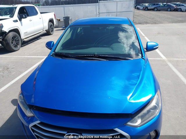 KMHD84LF1HU135831 Hyundai ELANTRA GL