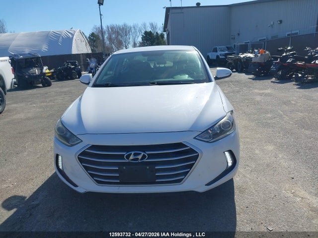 KMHD84LF1HU335995 Hyundai ELANTRA GL