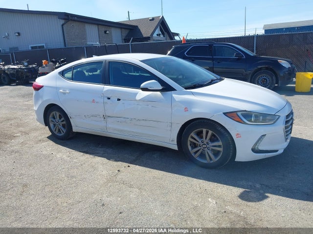 KMHD84LF1HU335995 Hyundai ELANTRA GL