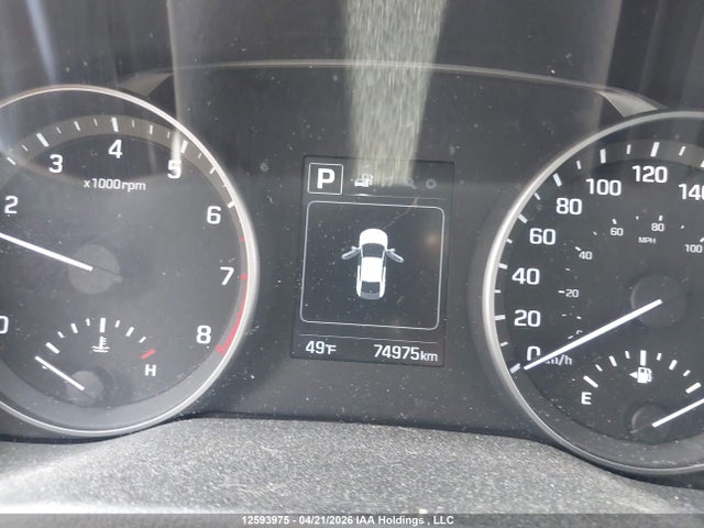 KMHD84LFXJU680724 Hyundai ELANTRA GL