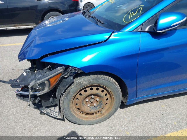 KMHD84LFXJU680724 Hyundai ELANTRA GL