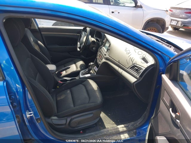 KMHD84LFXJU680724 Hyundai ELANTRA GL