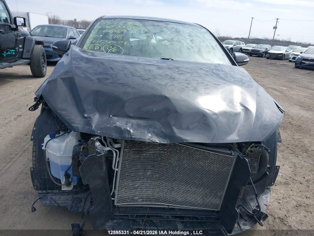 KMHD84LF1JU668770 Hyundai ELANTRA GL
