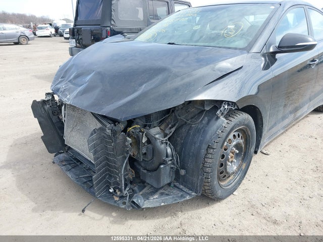 KMHD84LF1JU668770 Hyundai ELANTRA GL